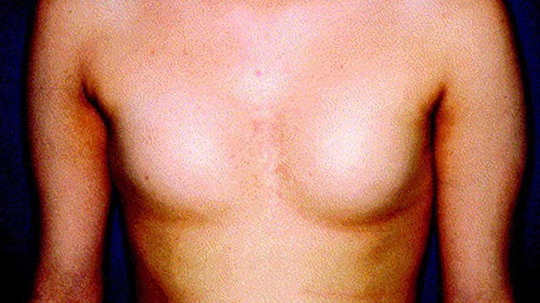 Image default